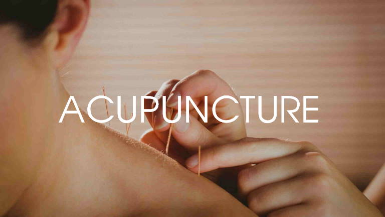 Acupuncture nyc