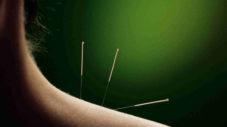 Why-Acupuncture